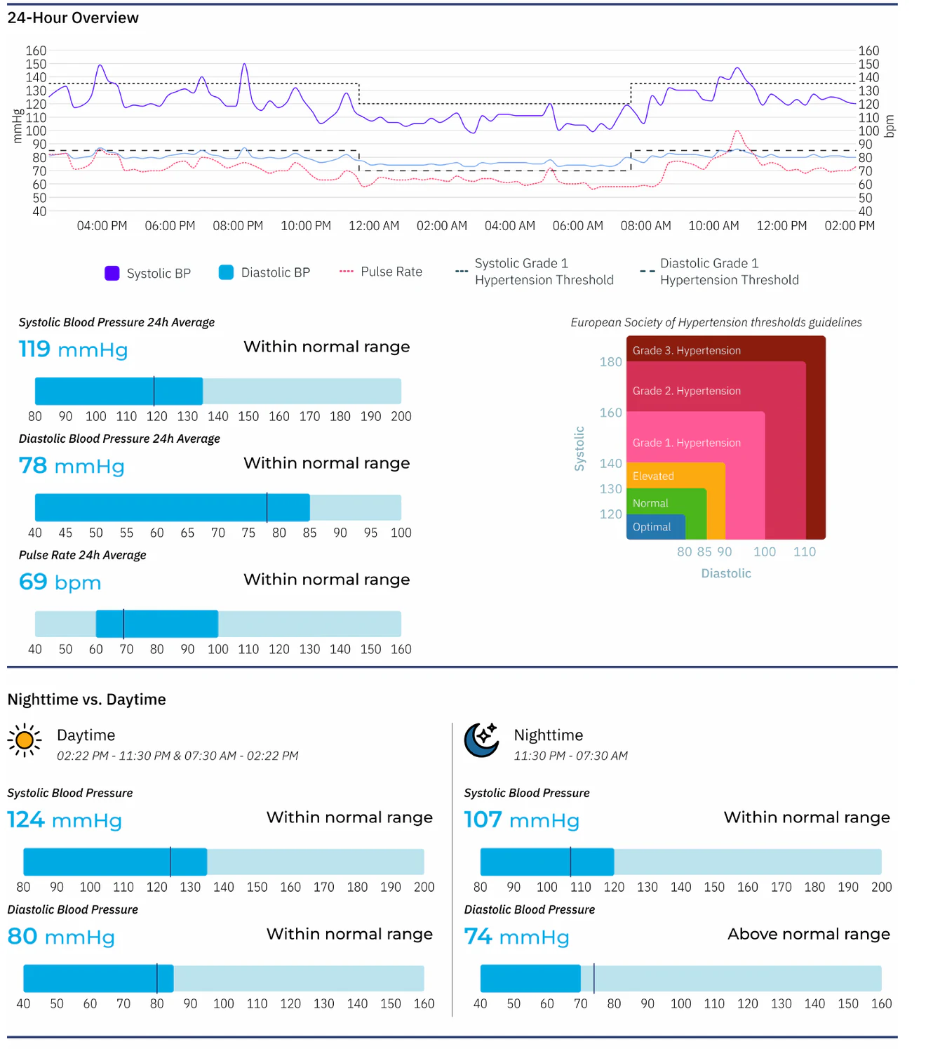Extracto anonimizado de un reporte Biobeat con curva de presión arterial de 24 horas y comparación diurna y nocturna